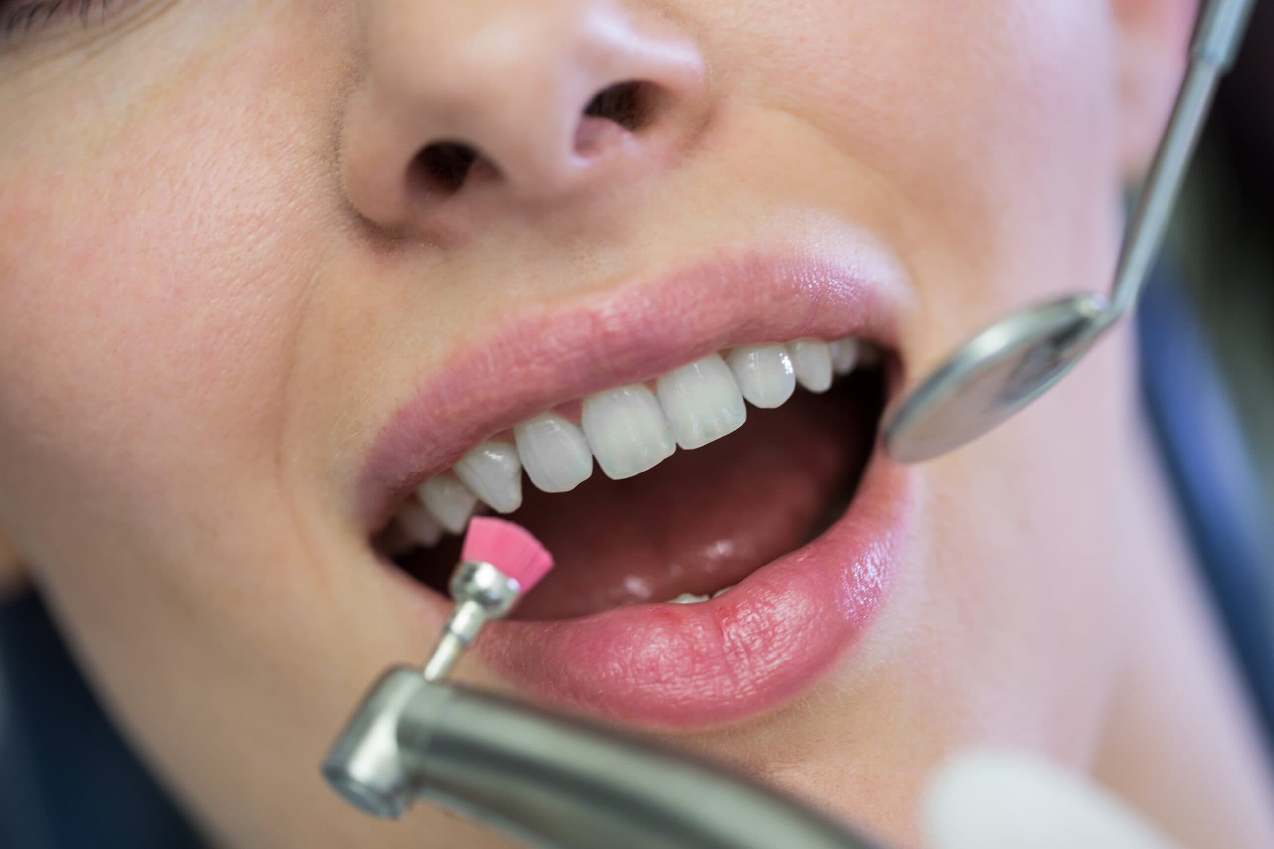 Dentalhygiene / Prophylaxe